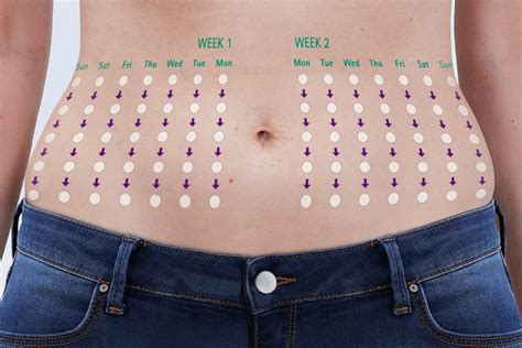 Diagram of the recommended Wegovy subcutaneous injection area on the abdomen, avoiding the 2-inch radius around the navel and any scar tissue or stretch marks